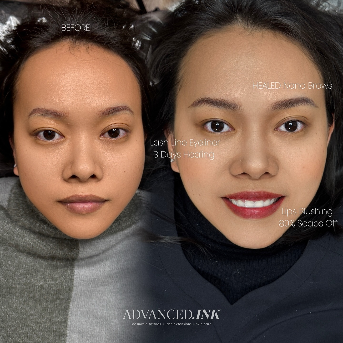 Advanced.Ink - RECLAIM BEAUTY, REDEFINE CONFIDENCE! ... | Facebook