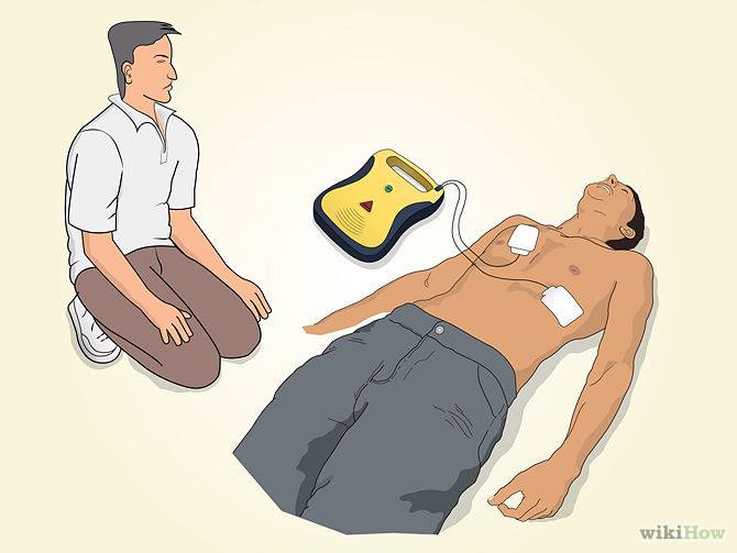CAB หรือ ABC ใน CPR AHA- American Heart Association พี่ใหญ่ของวงการช่วย ...