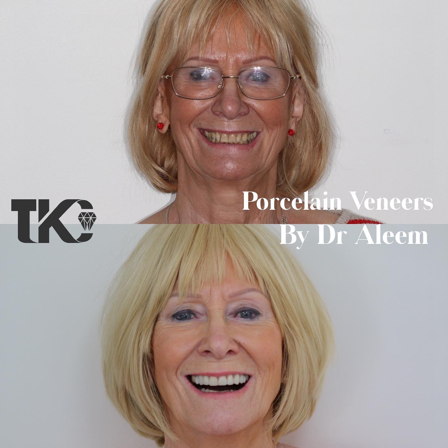 The Kensington Clinic - A transformative smile design by Dr Aleem ...