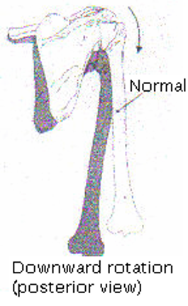 The Scapula: Normal position:... - Seddon Physiotherapy | Facebook