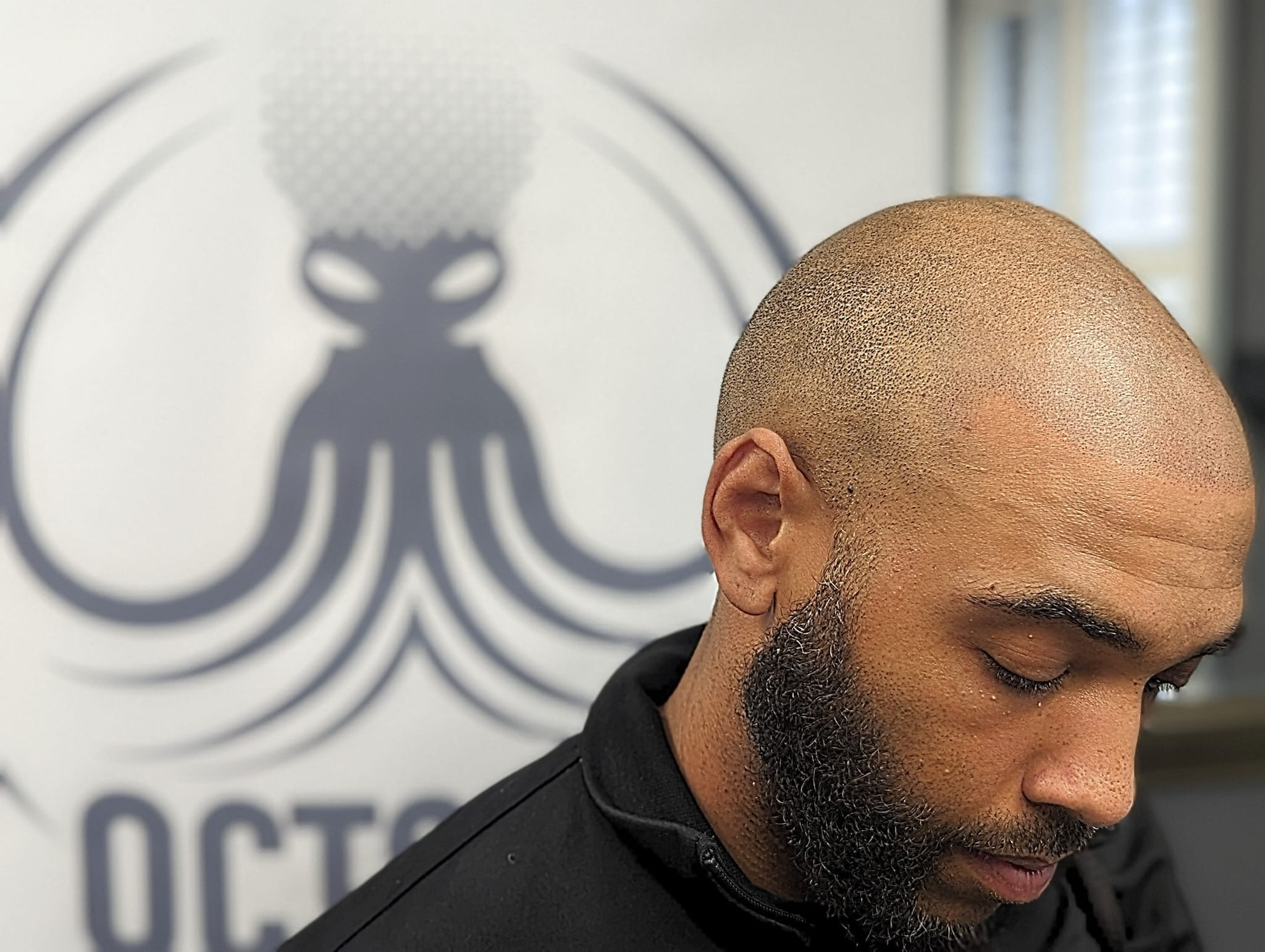 Octoink Scalp Micropigmentation