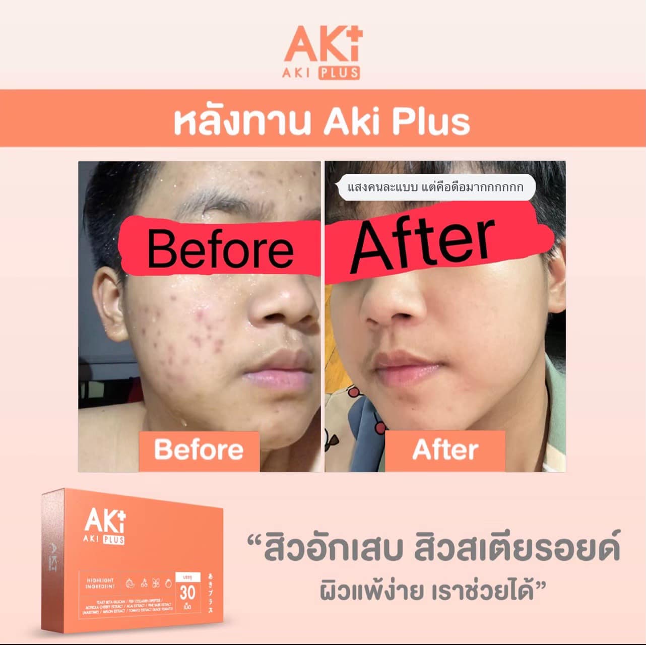 AKI PLUS... - AKI PLUS Thailand วิตามินผิวสวย ตัวแทนรายใหญ่