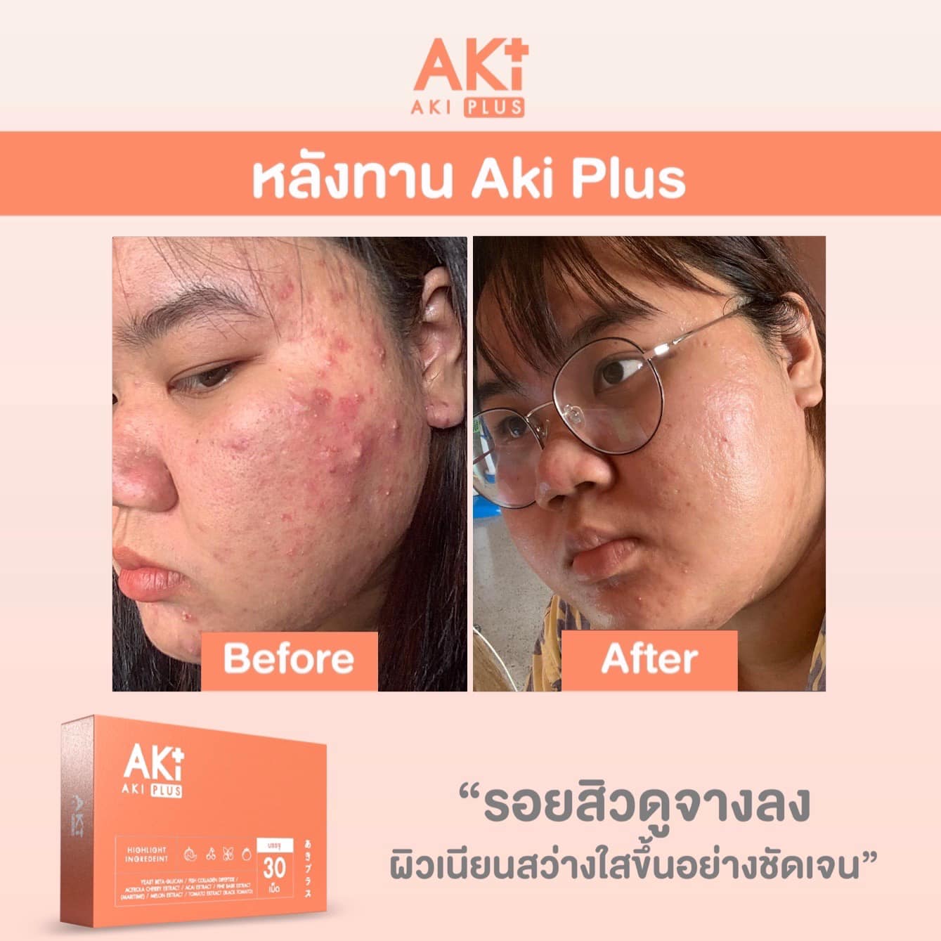 AKI PLUS... - AKI PLUS Thailand วิตามินผิวสวย ตัวแทนรายใหญ่