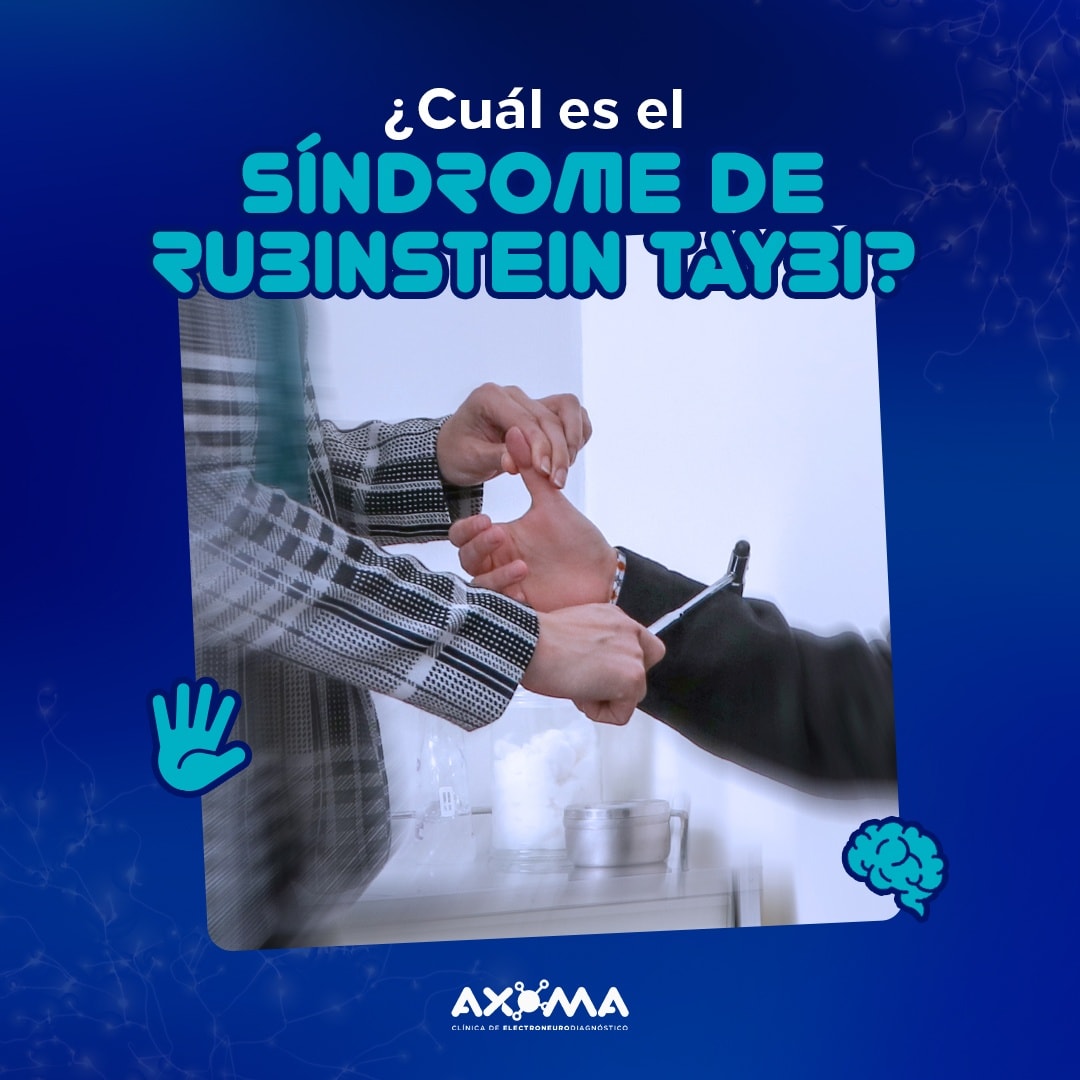 Axoma - 🔺 Es una enfermedad genética que se caracteriza... | Facebook