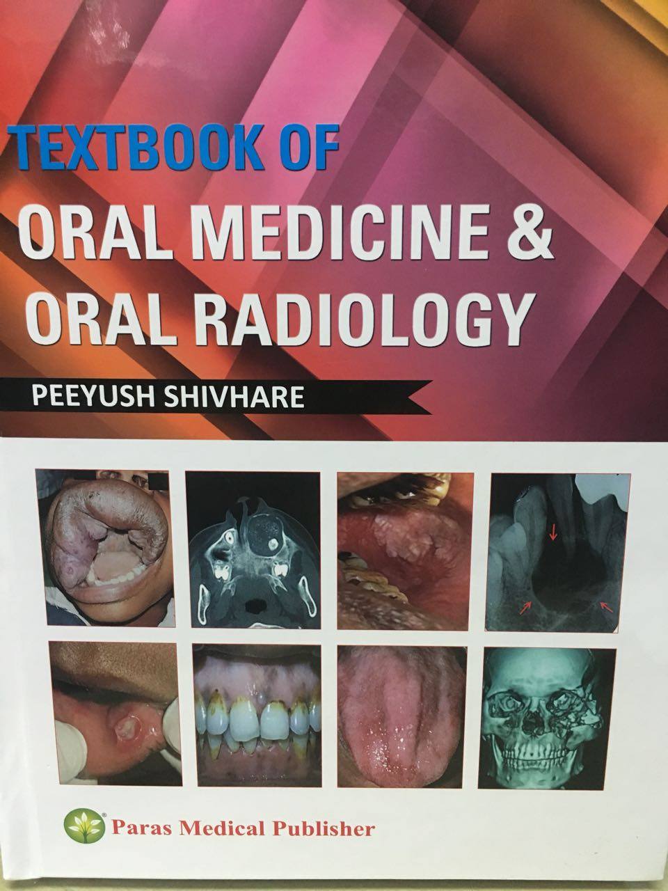 Textbook of oral medicine and radiology by Dr peeyush shivhare