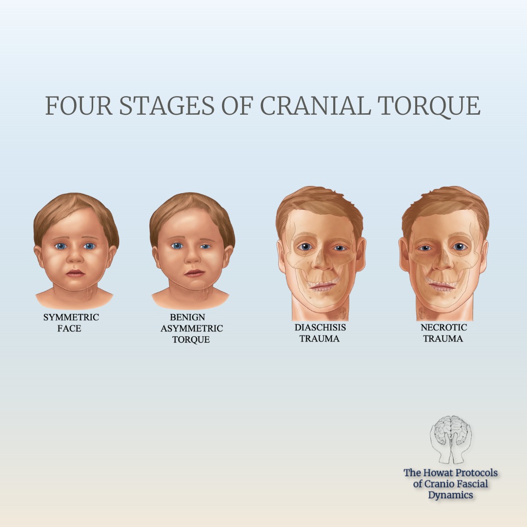 Howat Protocols Of Cranio Fascial Dynamics