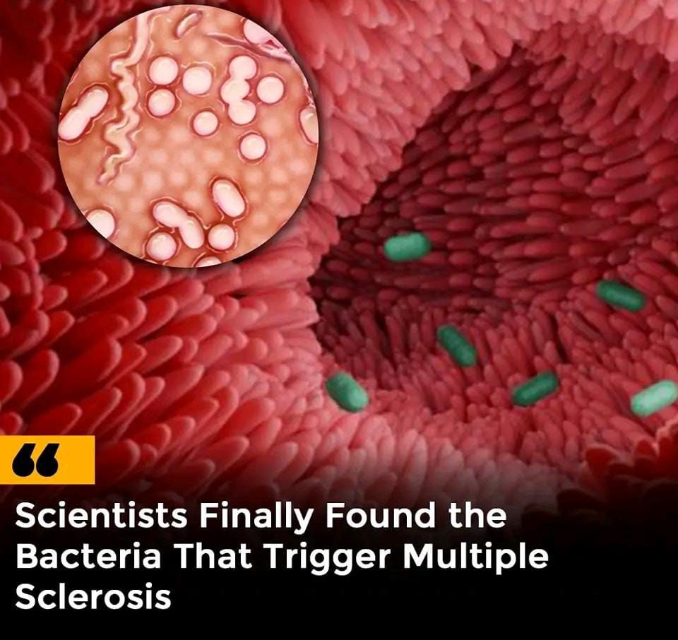 Daily - Researchers comparing 81 twin pairs found higher levels of ...