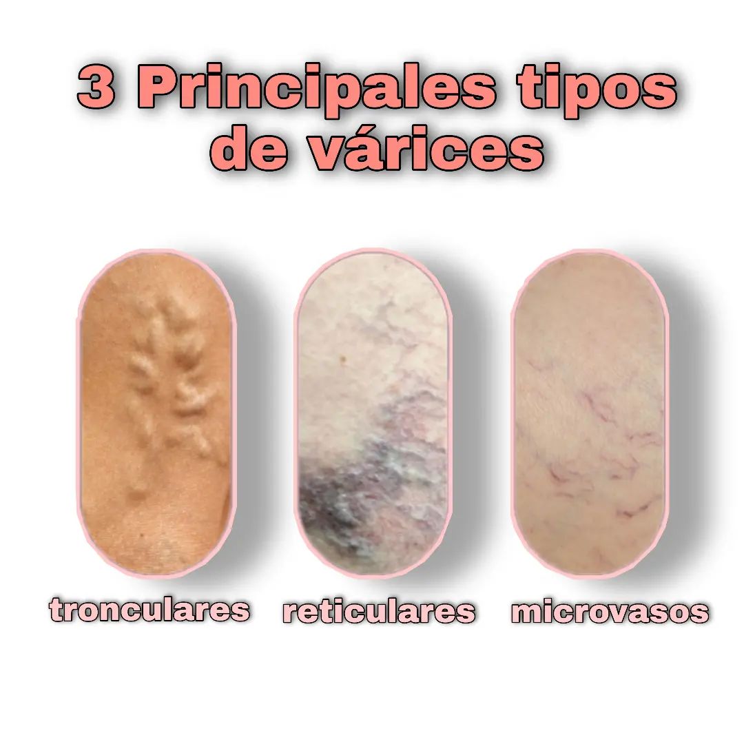 Te presentamos... - Porto Bela Medicina Estetica y Anti-Aging | Facebook
