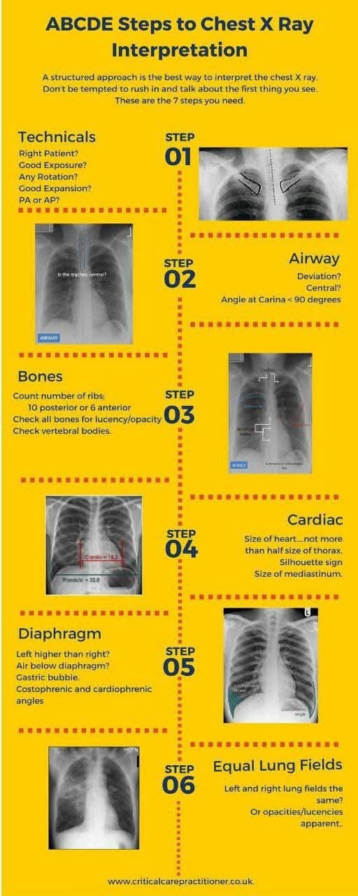 Radiography technique x ray tips
