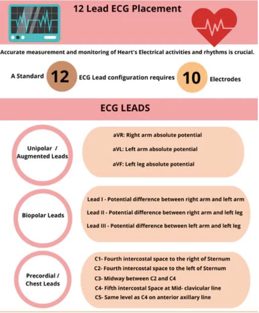 A guide on the 12 lead ecg / electrode... - Biometric Cables