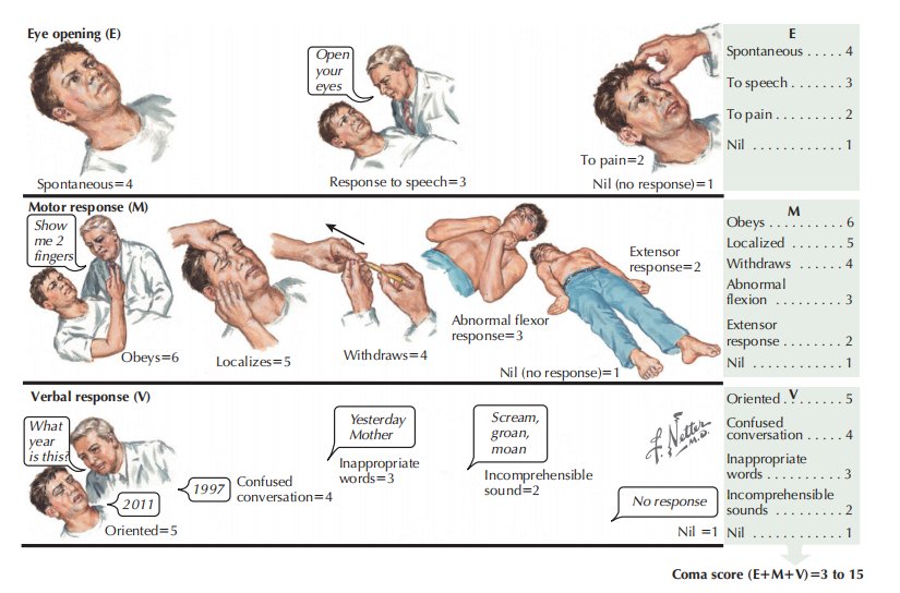 Neurology - GCS The Glasgow Coma Scale assesses and... | Facebook
