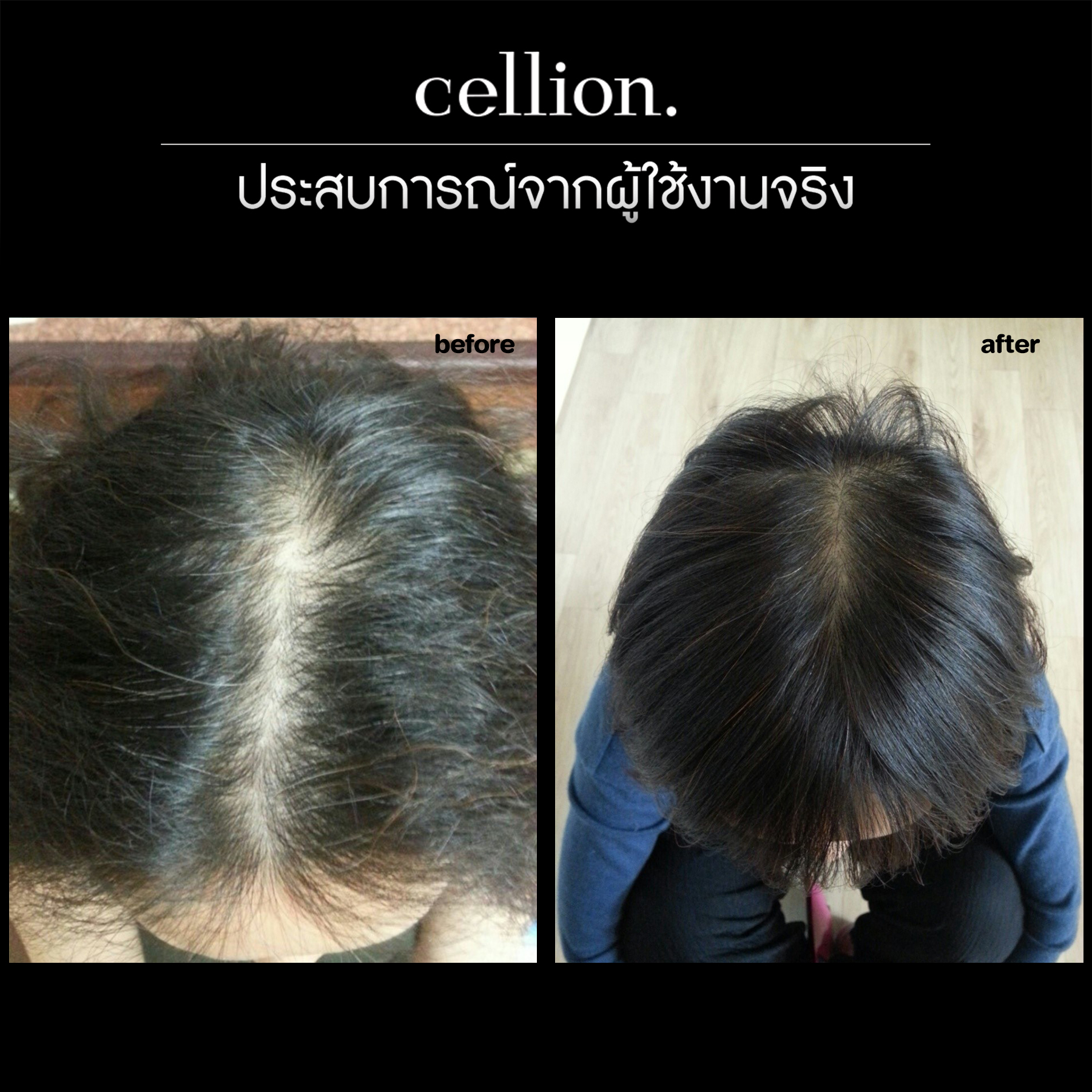 Cellion - 📌 หยุดผมร่วงจริง ผมหนาขึ้นจริง จากผู้ใช้จริง 🌈... | Facebook