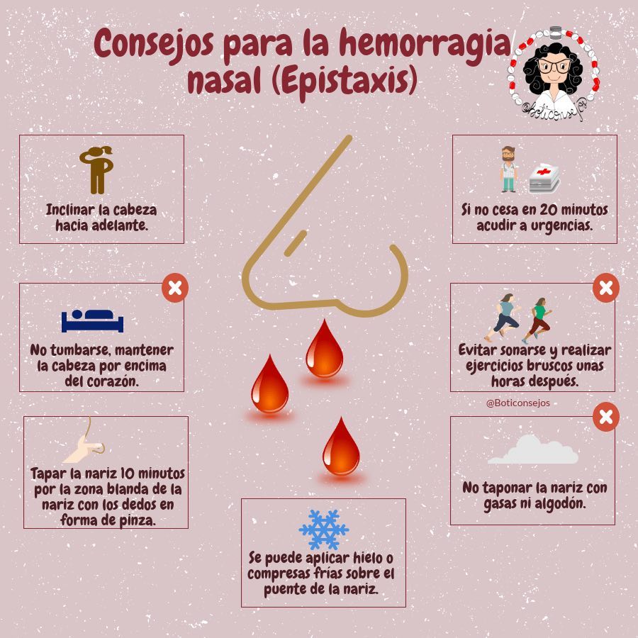 la-epistaxis-o-hemorragia-nasal-no-es-algo-de-extrema-urgencia-pero