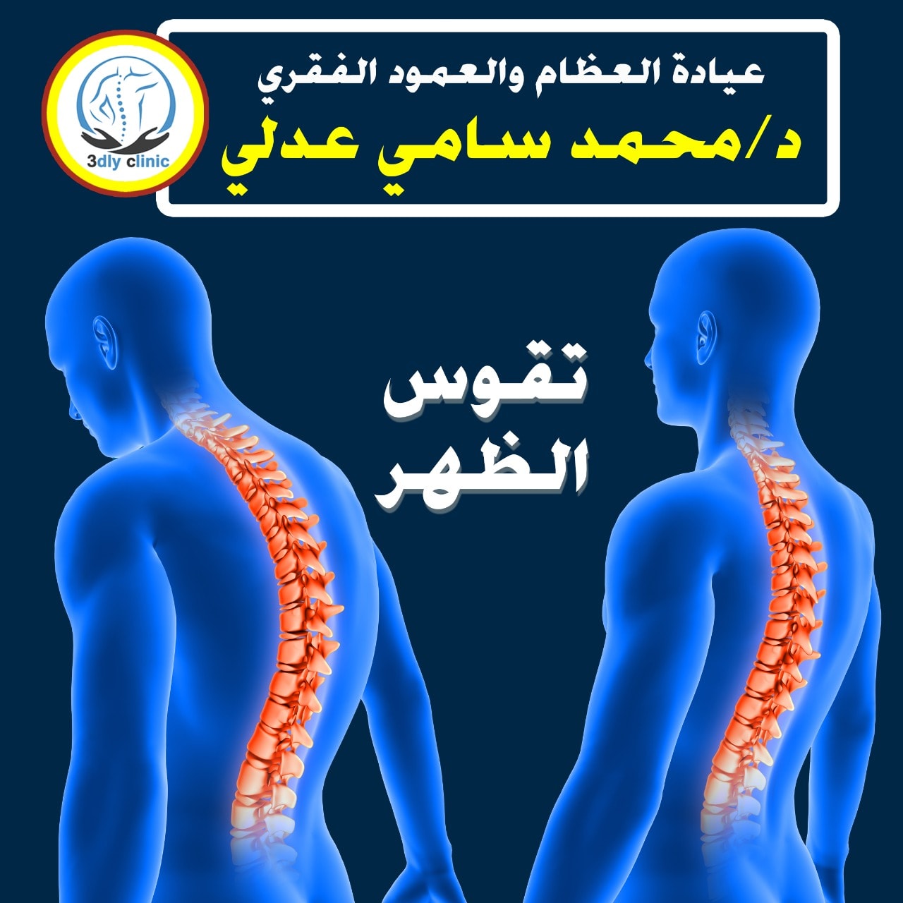 عيادة العظام والعمود الفقرى د.محمد سامى عدلى - أسباب تقوس الظهر ⬇️ ☑ ...
