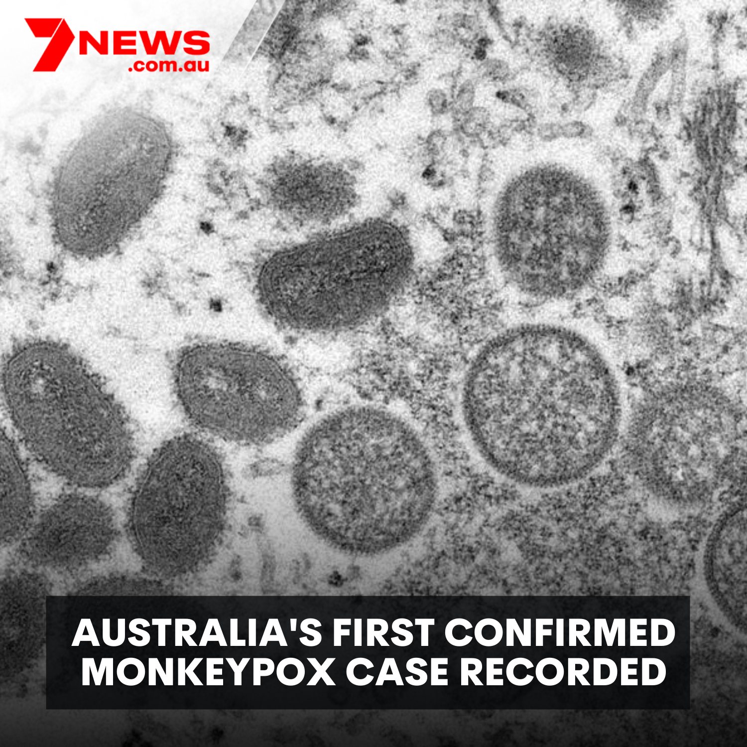 7NEWS Sydney - A case has been confirmed in Melbourne just...