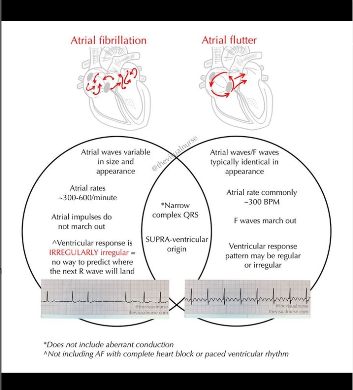 Atrial Fibrillation... - Dr Boon Lim, Consultant Cardiologist | Facebook