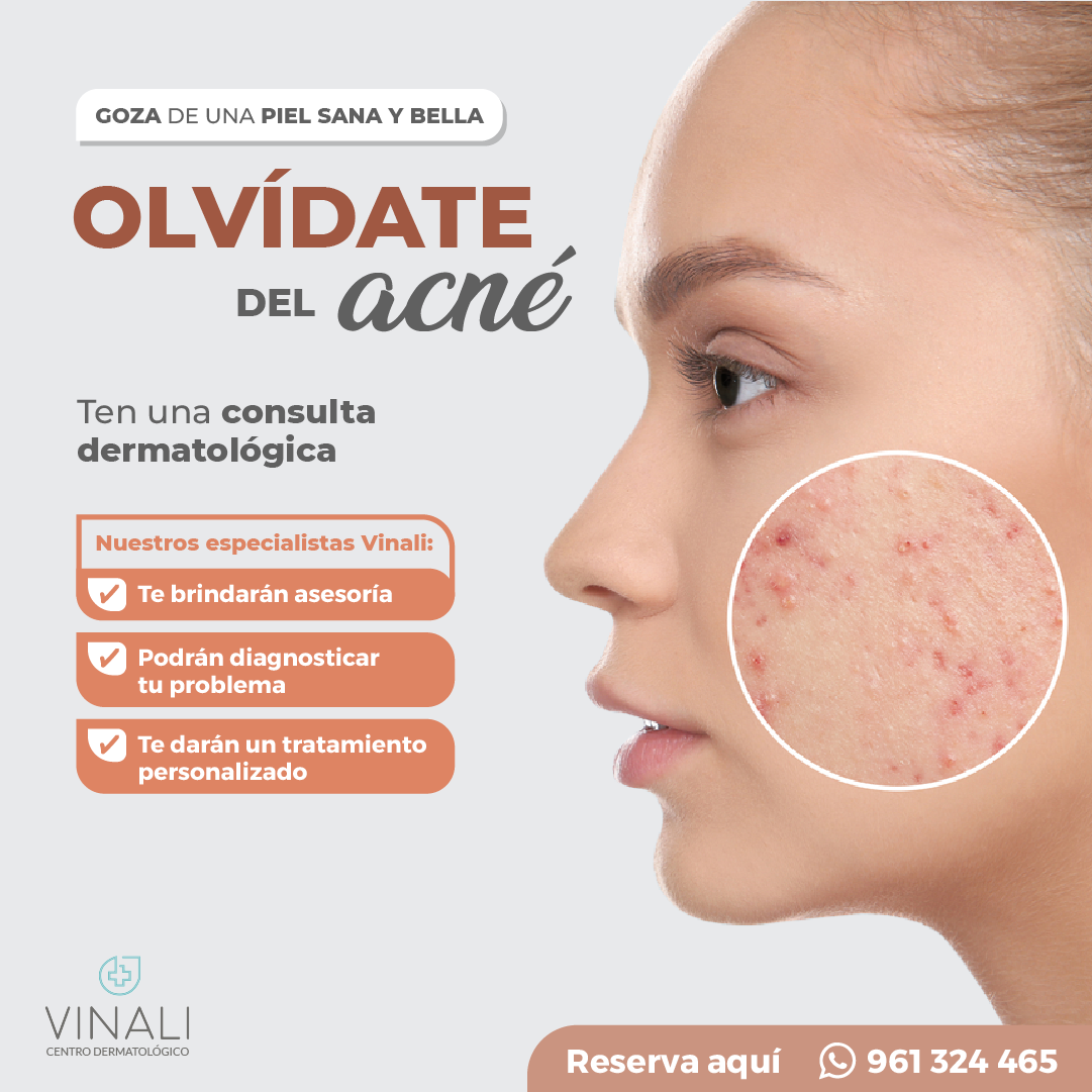 Mejora el aspecto de tu... - Centro Dermatológico Vinali | Facebook