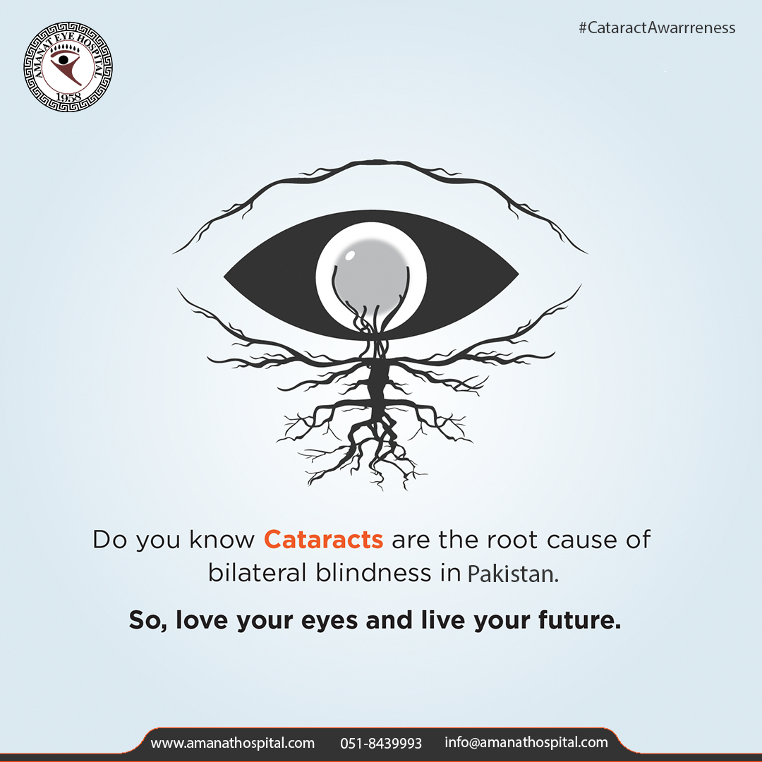 Do you Know Cataracts are the root... - Amanat Eye Hospital