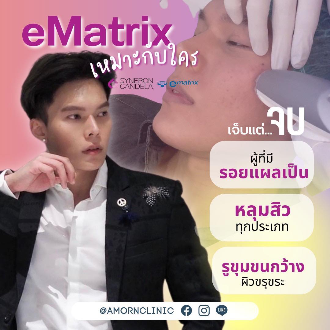 Amorn Clinic - Ematrix เหมาะกับใคร เครื่องที่ใช้เทคโนโลยี...