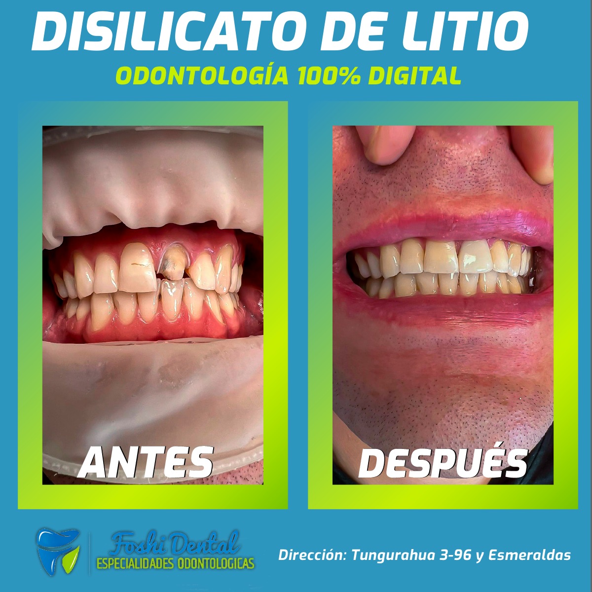 Foshi Dental | Cuenca