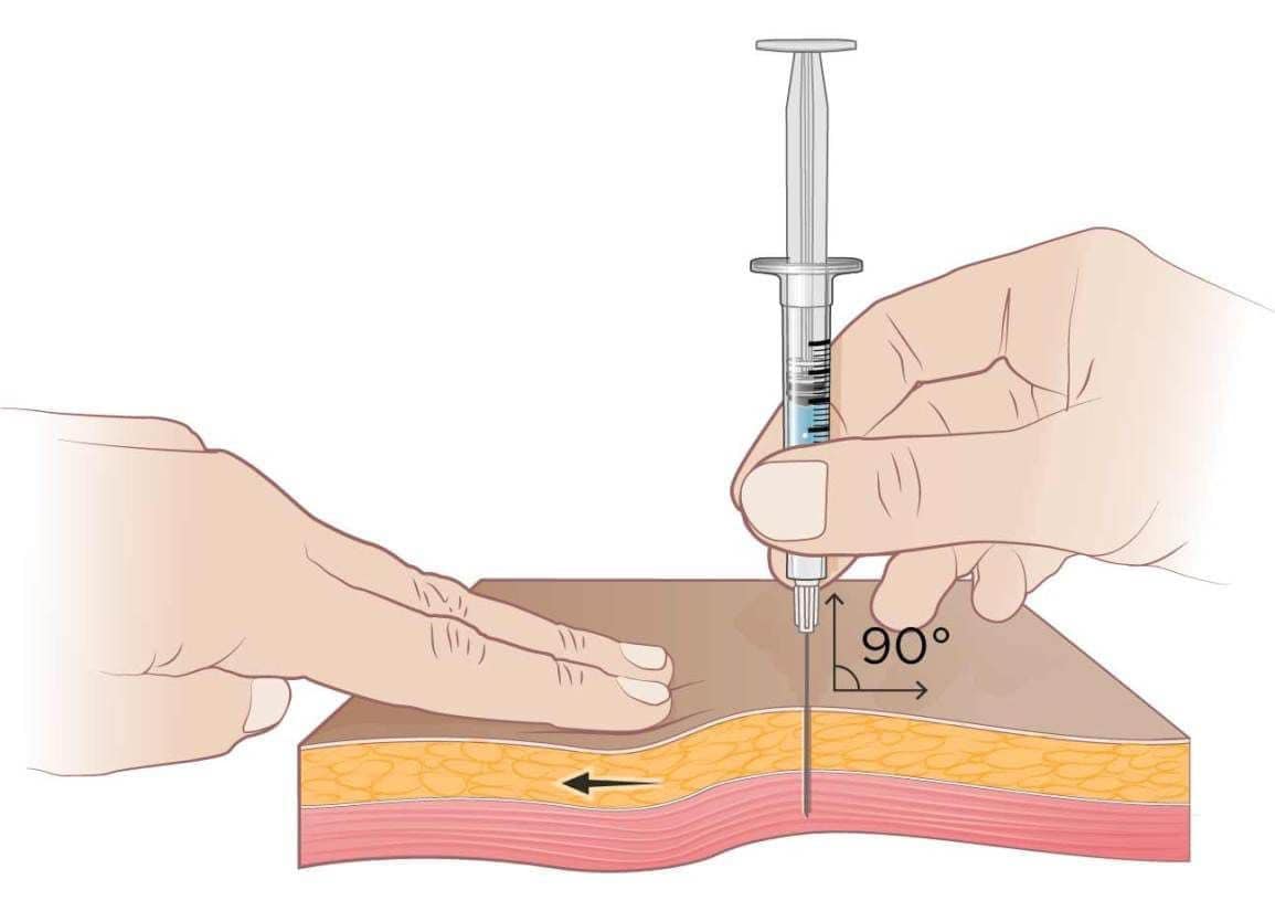 The Z-Track method is a technique used to administer IM injections. The method helps minimize discomfort and reduce the risk of medication leaking into subcutaneous tissue! #ztrack #nursing #nurse #nurseinjector #nursestudent #nurseproblems #