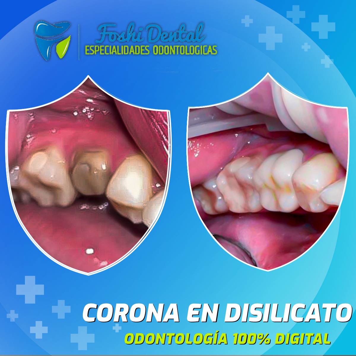 Foshi Dental | Cuenca