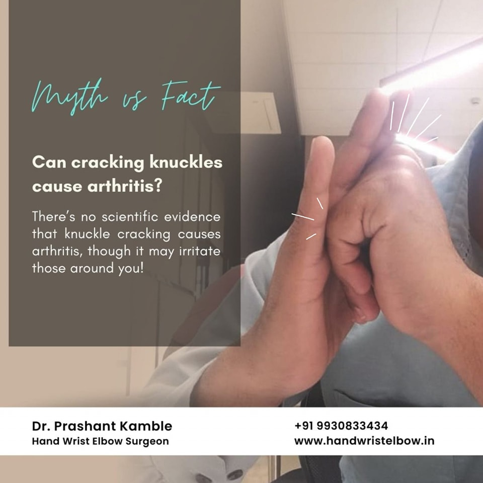 Dr. - 🖐️ Myth or Fact: Does Knuckle Cracking Cause Arthritis? 🤔 Myth ...