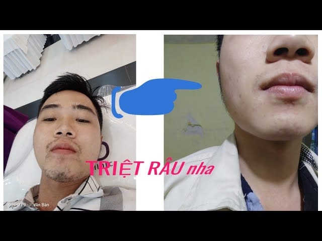 Hội AE triệt râu | Facebook