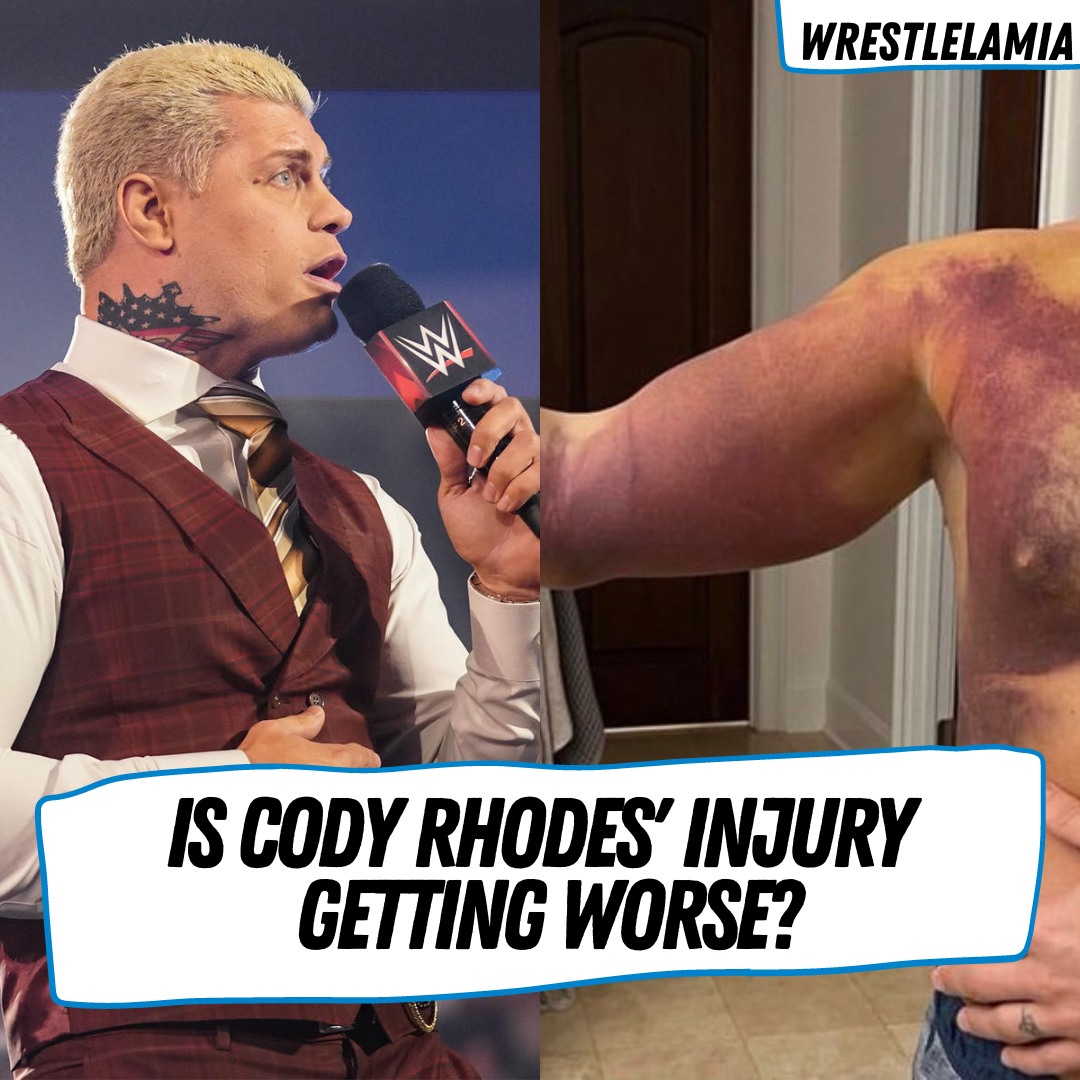 Cody Rhodes has shown off his injury,... - Wrestlelamia.com | Facebook