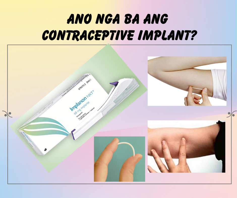Ugat ng Kalusugan RH Clinic - Ito ang Implant na ginagamit natin dito ...