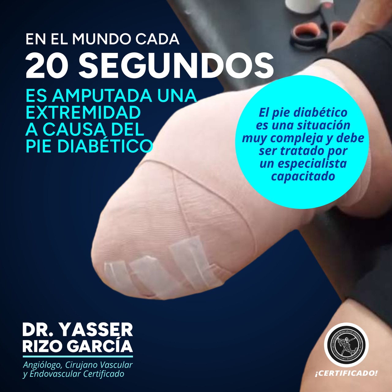 El pie diabético es una de las... - Doctor Yasser Rizo