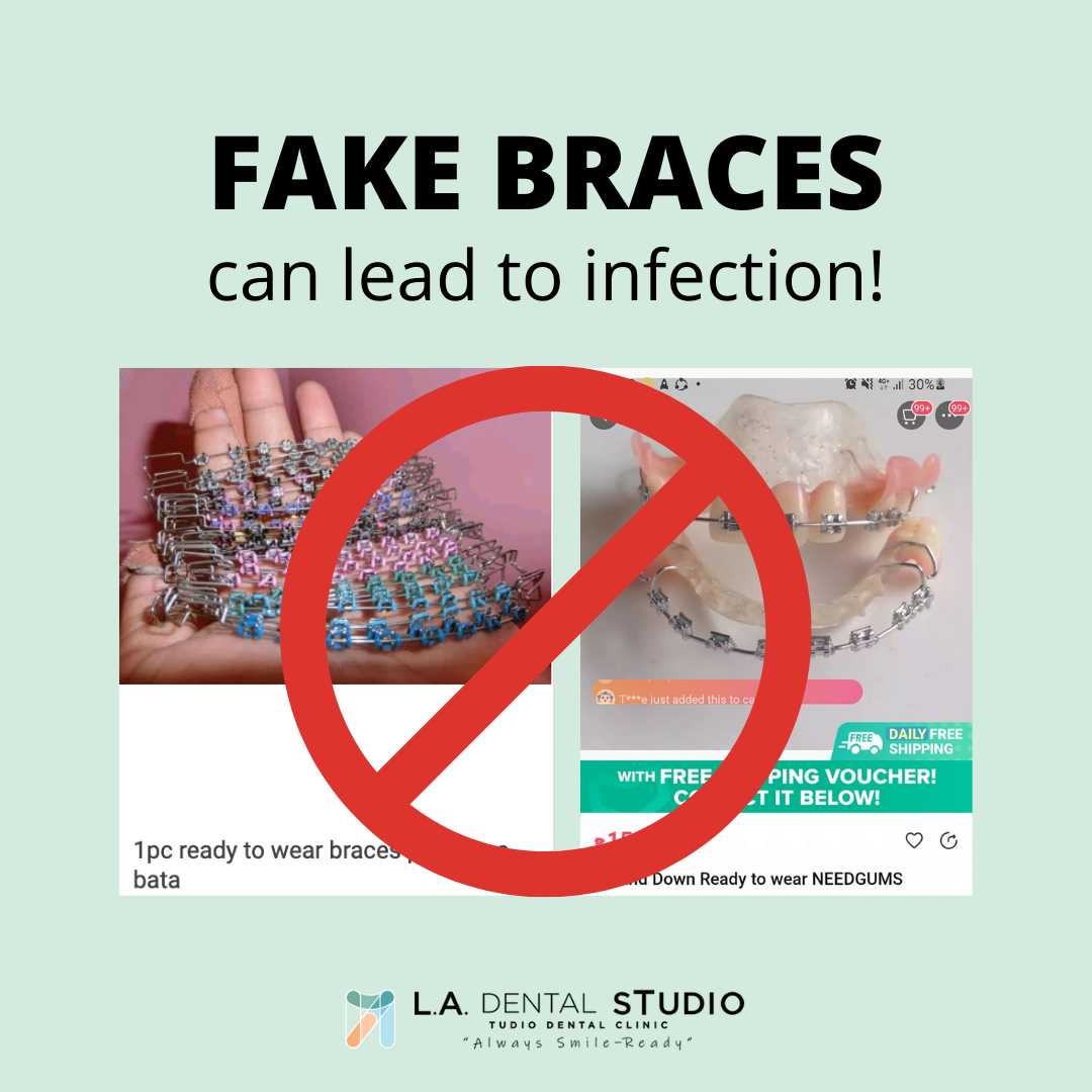 Fake braces can lead to inflammation... - L.A. Dental Studio