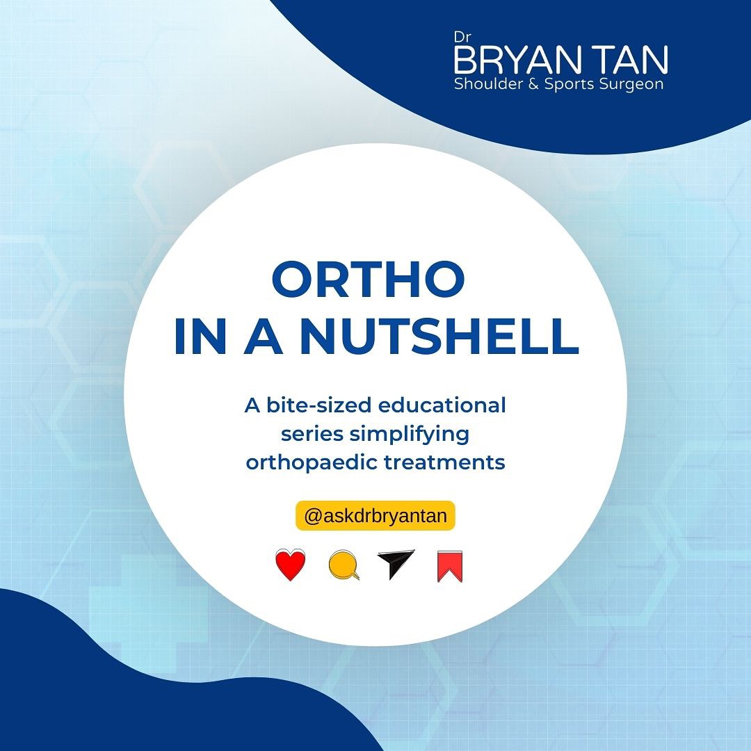 Dr Bryan Tan - 🩹 Ortho in a Nutshell: Rotator Cuff... | Facebook