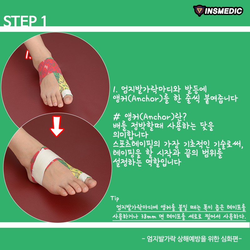 국제테이핑 - - 국제테이핑 Taping Guide - 발가락 상해예방 심화테이핑입니다! 그동안의...