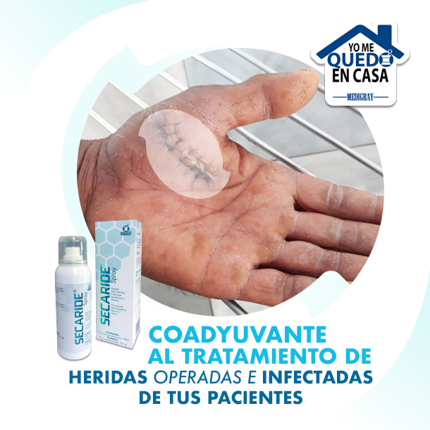 Secaride - La correcta aplicación de SECARIDE ayudará a:...