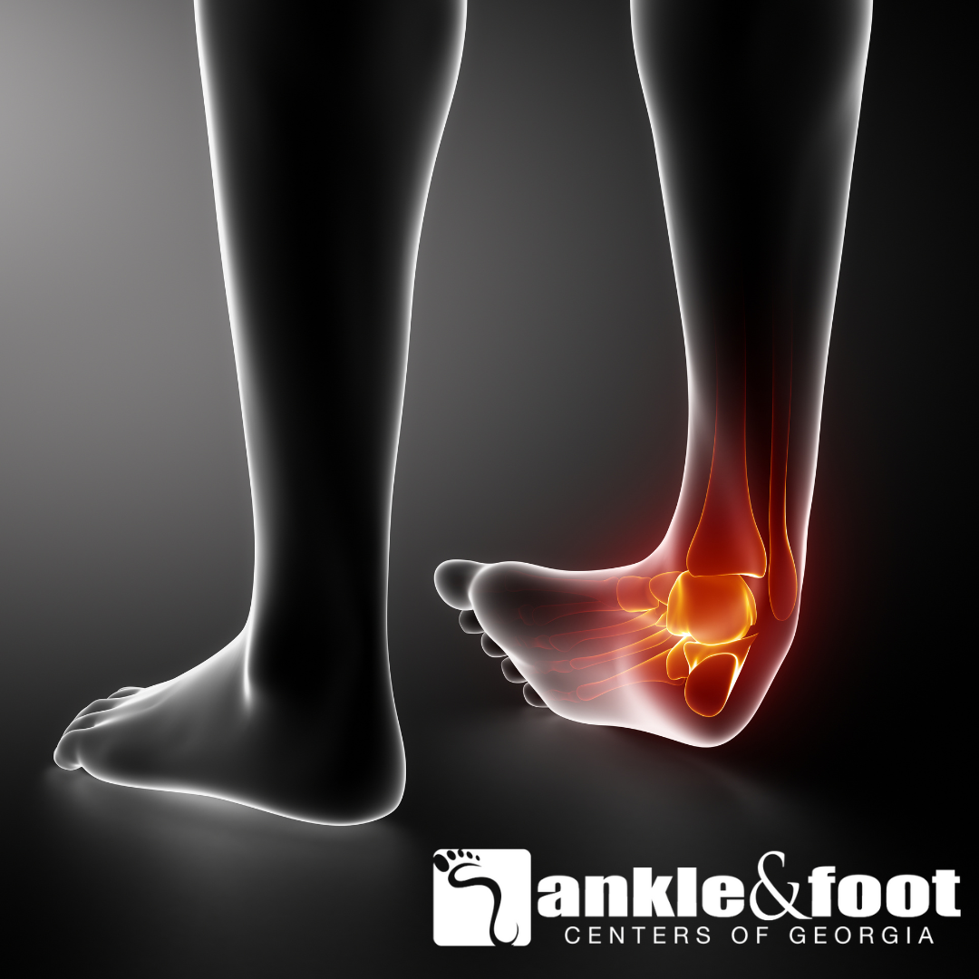 The most... - Ankle & Foot Centers of America - Perimeter