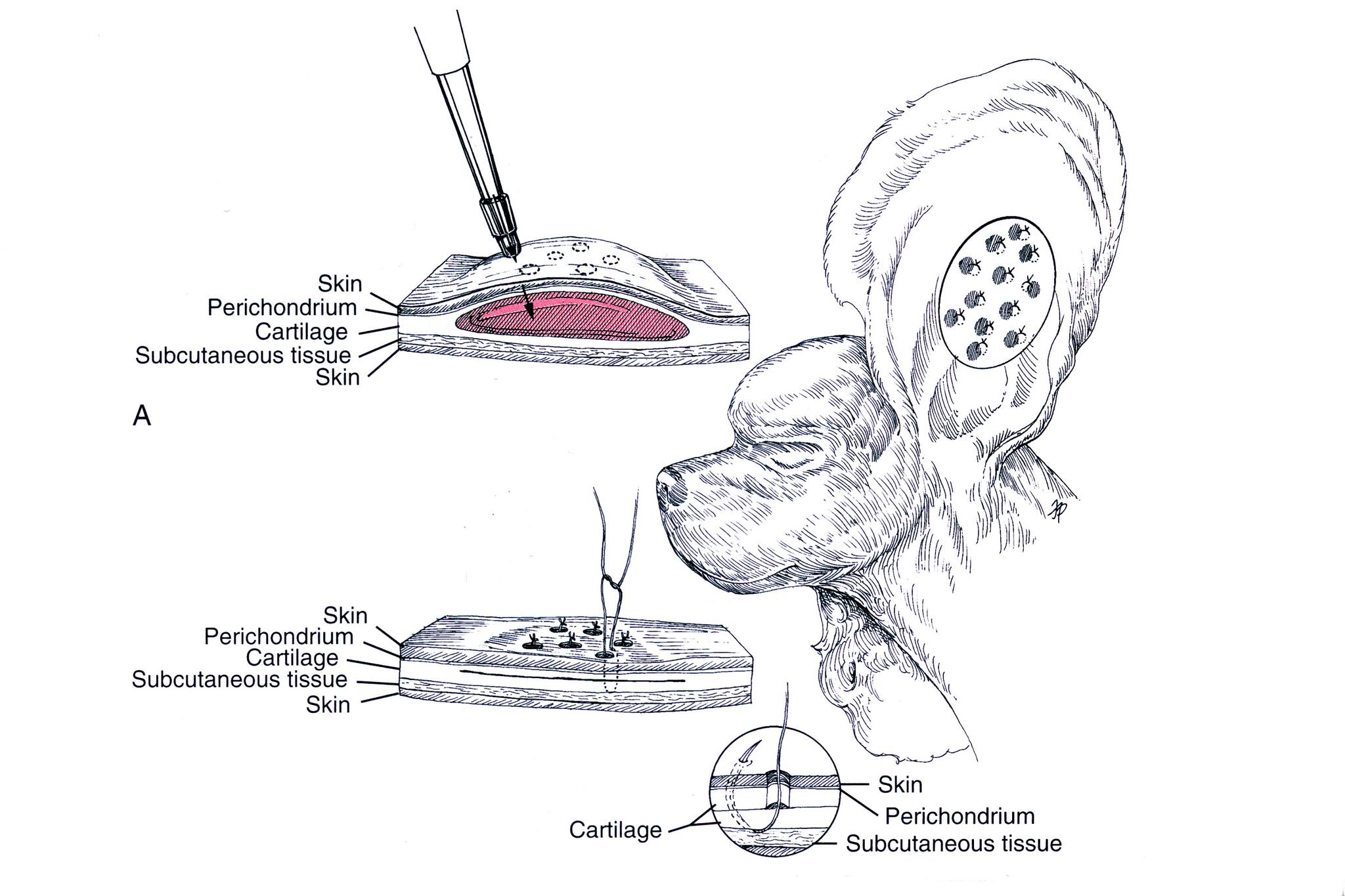 Dr. - A simple, cosmetic solution to aural hematomas. See: https ...