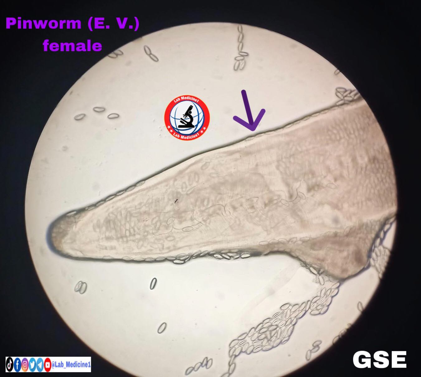 Lab Medicine1 - #pinworm female #gse #lab #laboratory...
