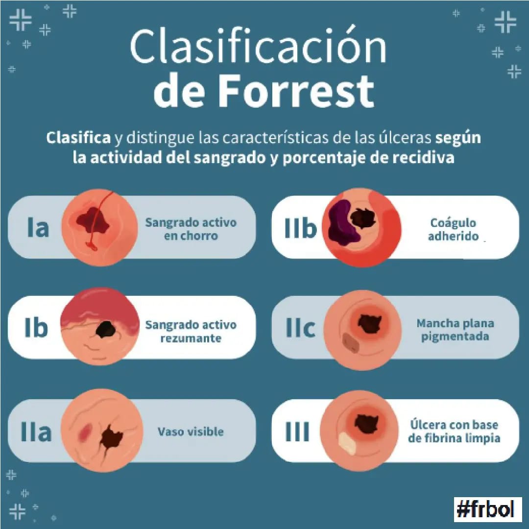 🌟 CLASIFICACIÓN DE FORREST EN... - Futuros Residentes Bolivia | Facebook