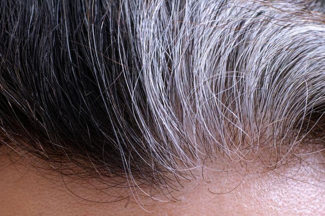 glutathione grey hair reddit I've worked with patients who have actually regained their natural color…not from a product, but from what was happening inside their body. Gray hair is closely tied to mitochondrial function…the energy Select Pack::60 Capsules Photo by SELINE Clinic i-size