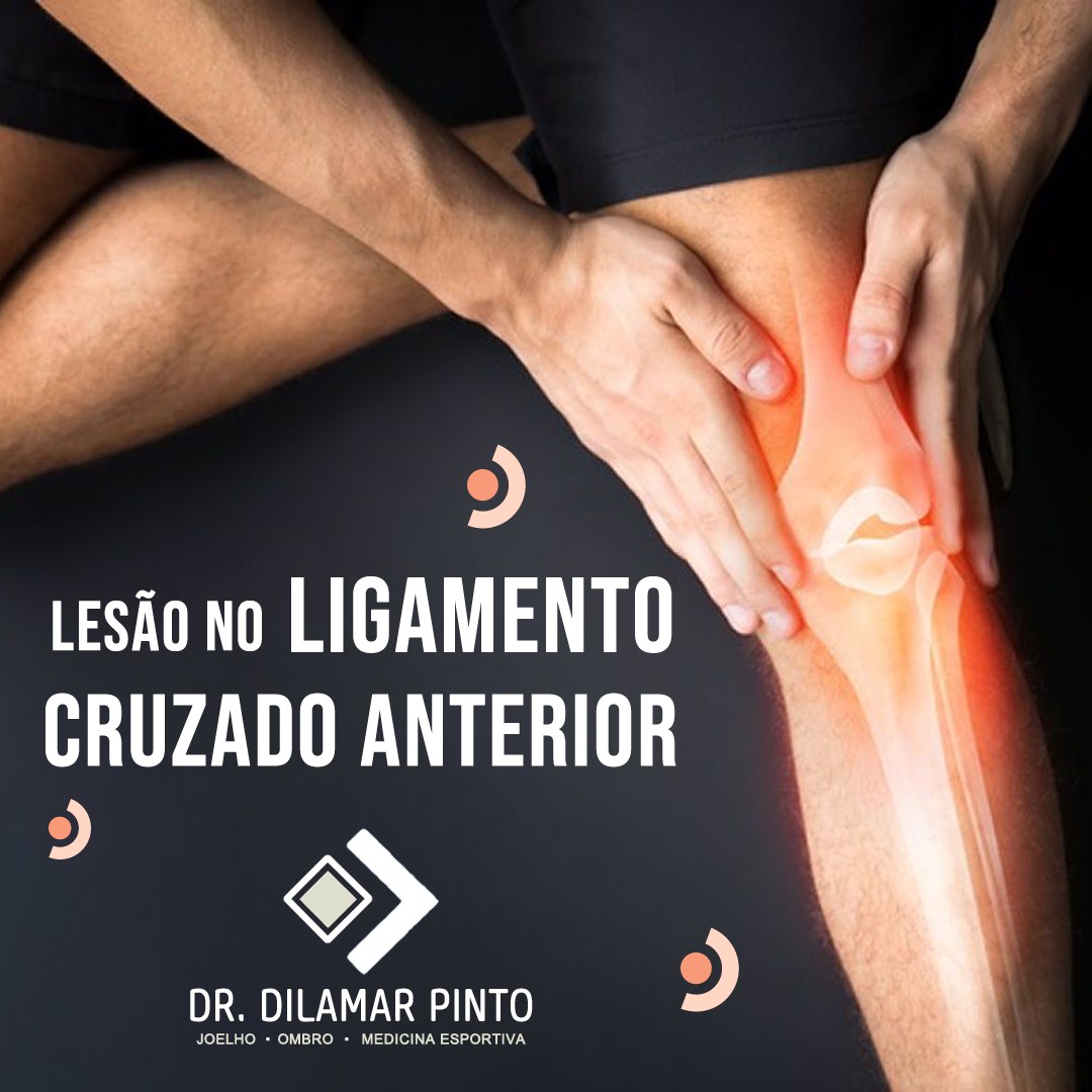 Dilamar Pinto - 🦵 Lesão no ligamento cruzado anterior.