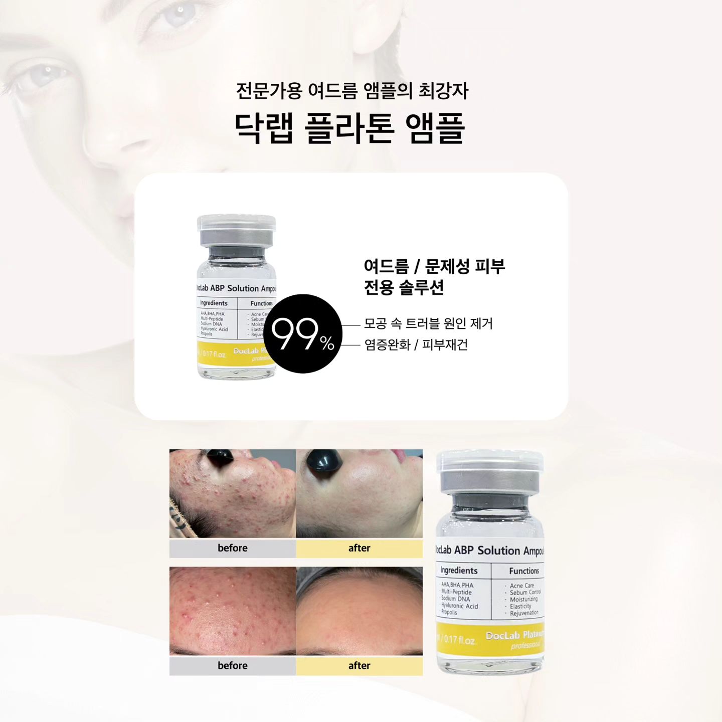 doclabkorea - 닥랩 플라톤 앰플, 전문가용 여드름 앰플의 최강자! DocLab ABP... | Facebook
