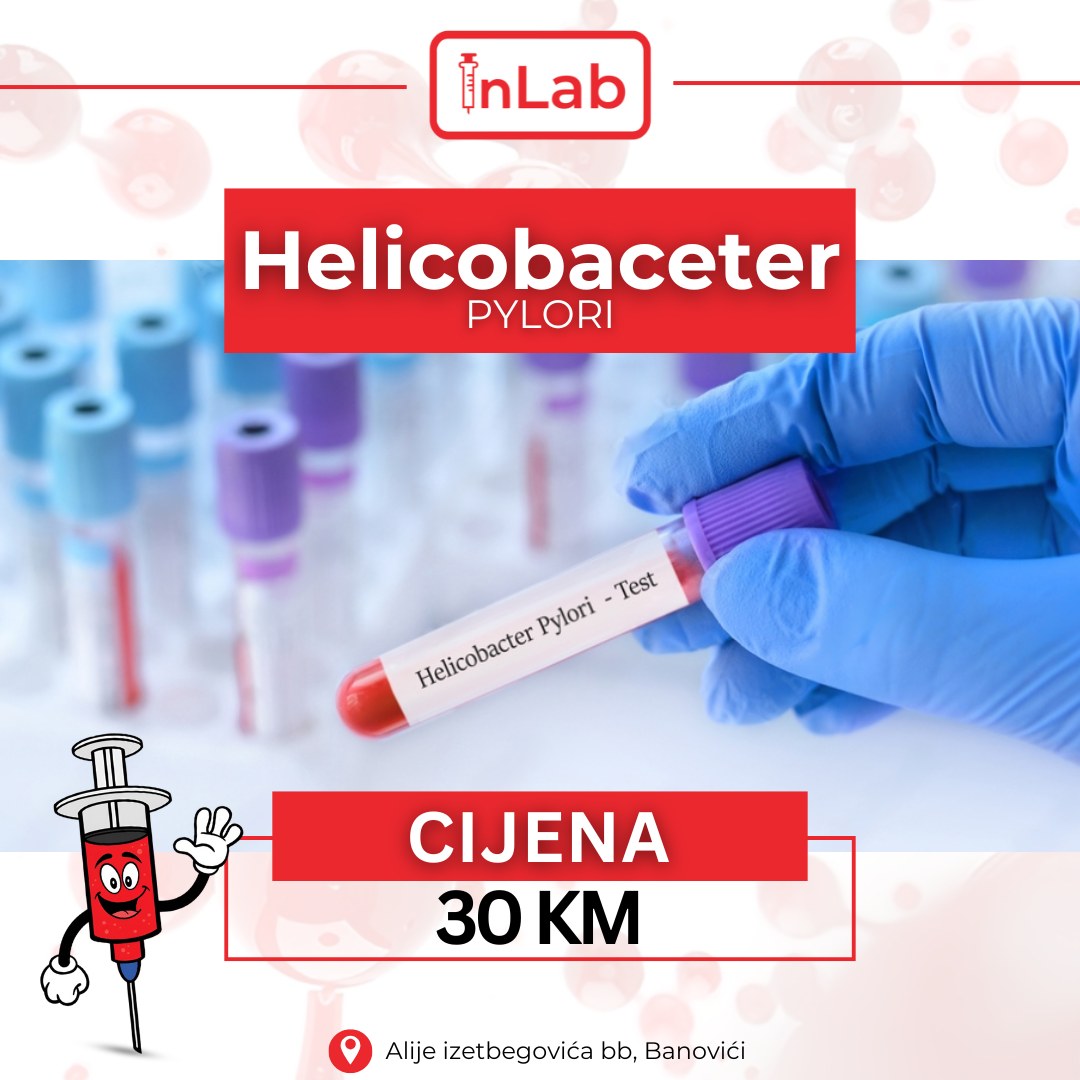 InLab Banovići Laboratorija | Banovici