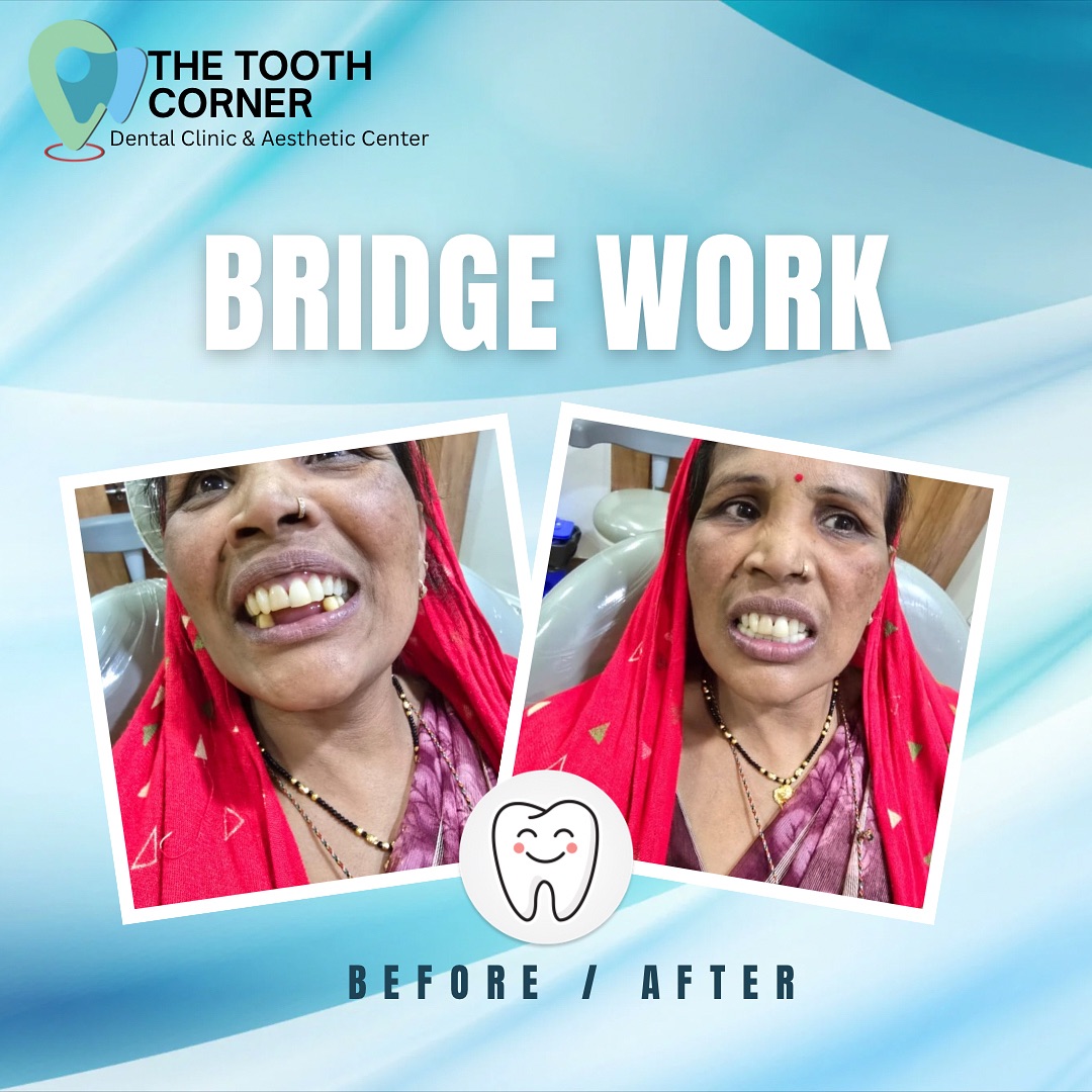 The tooth Corner | Indore