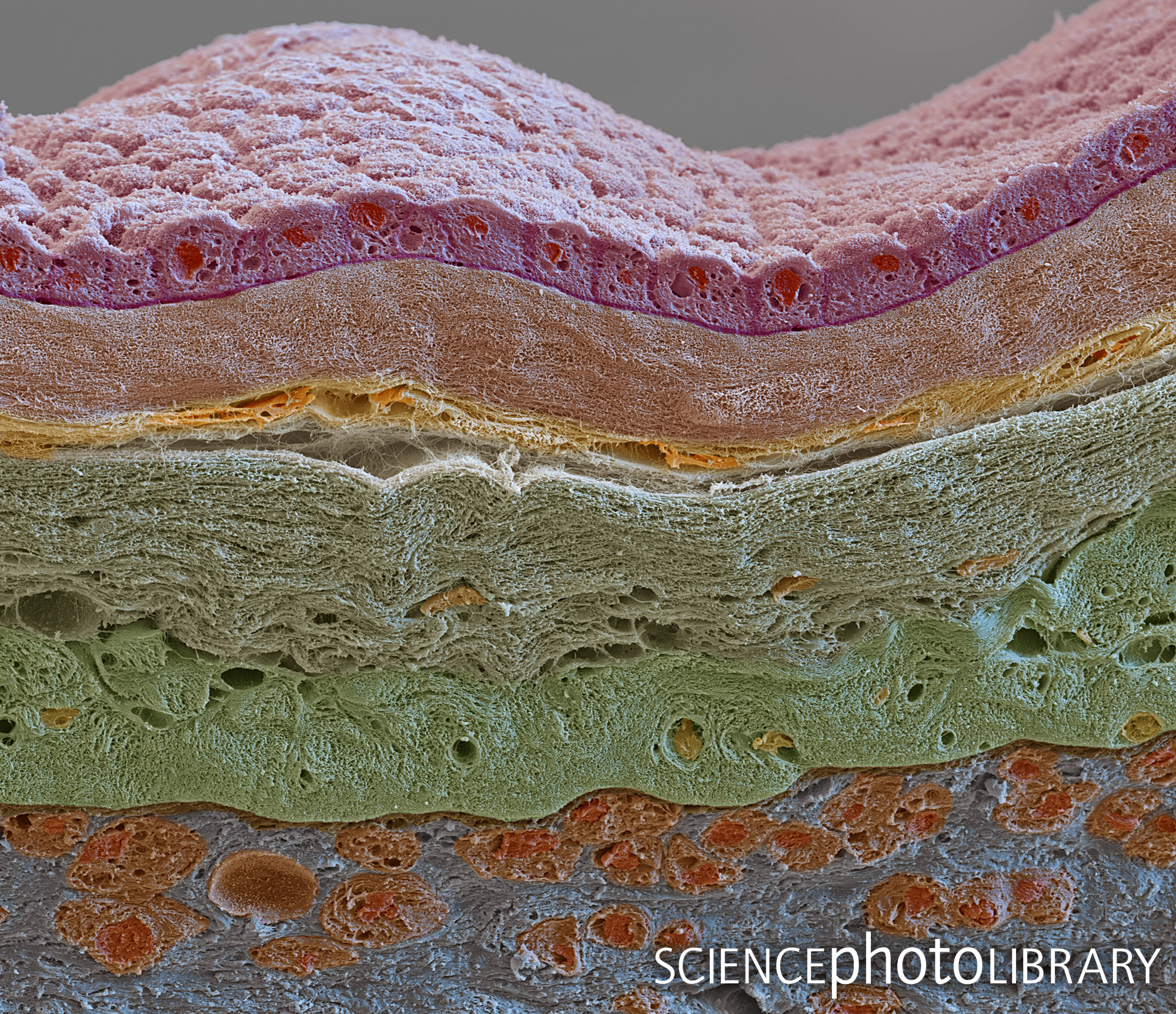 Science - Coloured scanning electron micrograph (SEM) of a freeze ...