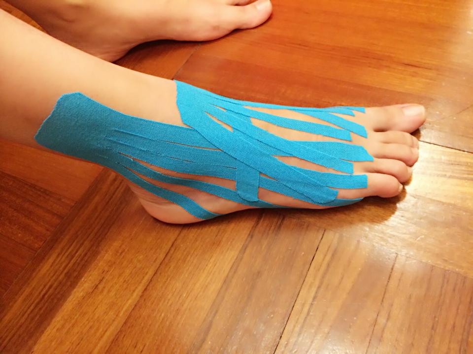 排球運動員常常會腳腕扭傷 然後整個腳都 肌內效貼布專家 Kinesiology Tape Specialist Facebook