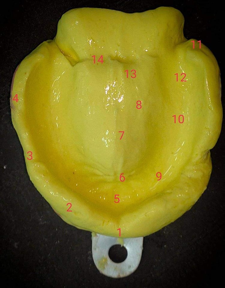 World - Detailed primary maxillary impression & some of anatomical ...