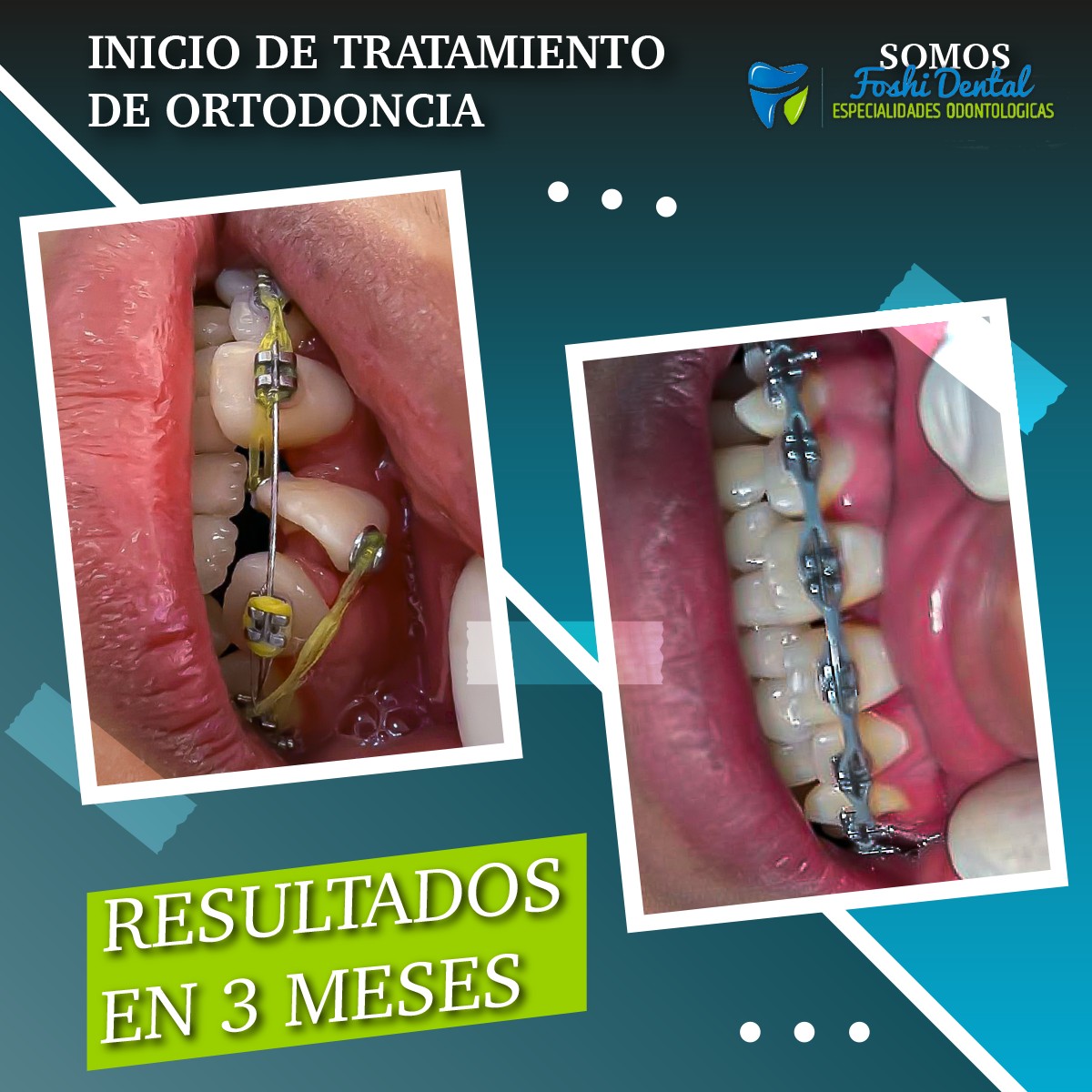 Foshi Dental | Cuenca
