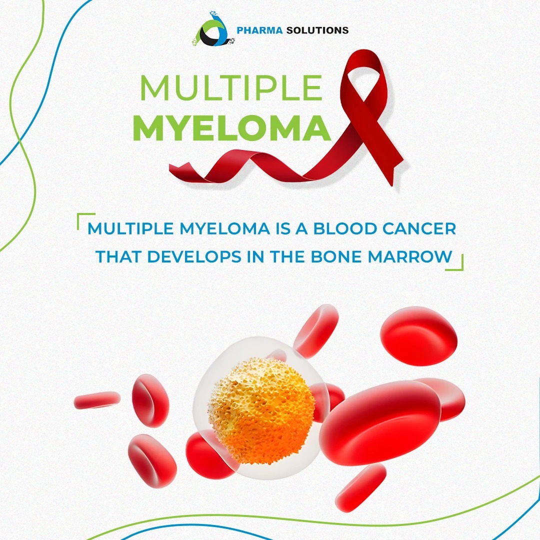 Multiple myeloma is cancer that forms... - Pharma Solutions