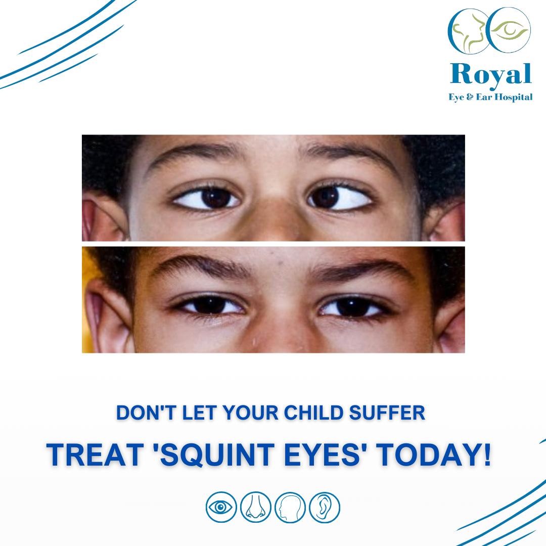 Royal - 👀 Attention! Strabismus in Children Needs Early Treatment. 👀 ...